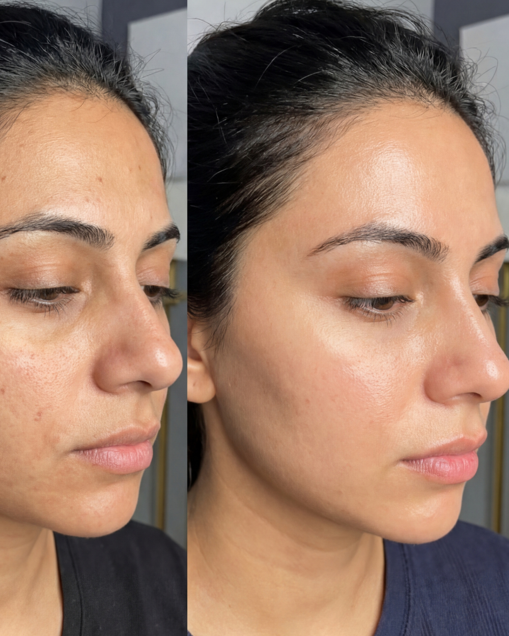 Rice Brightening Glow Facial Kit