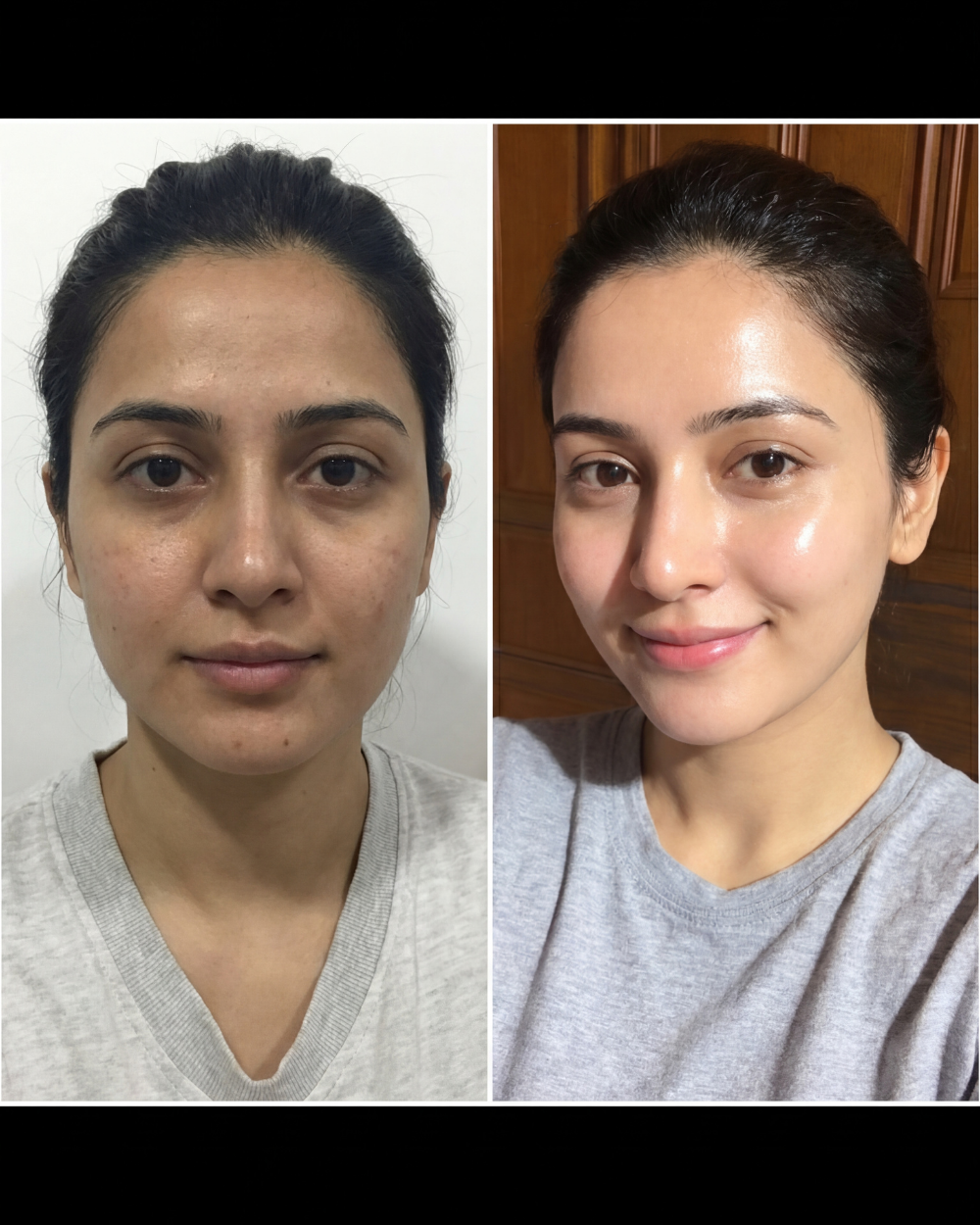 Rice Brightening Glow Facial Kit